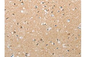 The image on the left is immunohistochemistry of paraffin-embedded Human brain tissue using ABIN7192728(TACR2 Antibody) at dilution 1/20, on the right is treated with synthetic peptide. (TACR2 Antikörper)