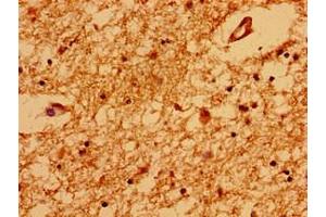 Immunohistochemistry of paraffin-embedded human brain tissue using ABIN7172228 at dilution of 1:100 (TRNP1 Antikörper  (AA 10-180))