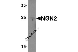 Western Blotting (WB) image for anti-Neurogenin 2 (NEUROG2) (C-Term) antibody (ABIN1077397)