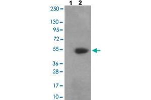 Western blot analysis of Lane 1: antigen-specific peptide treated 3T3 cells, Lane 2: 3T3 cells with CAMK2A/CAMK2B/CAMK2D (phospho T305) polyclonal antibody  at 1:500-1:1000 dilution. (CAMK2A Antikörper  (pThr305))
