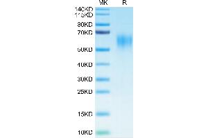 IL15RA Protein (His-Avi Tag)