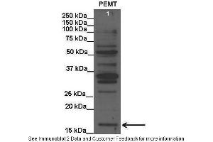 Lanes:   Lane1: 20 ug rat liver lysate  Primary Antibody Dilution:   1:1000  Secondary Antibody:   Anti-rabbit HRP  Secondary Antibody Dilution:   1:15000  Gene Name:   PEMT  Submitted by:   Anonymous (PEMT Antikörper  (C-Term))