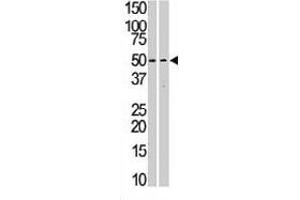 The STK38L polyclonal antibody  is used in Western blot to detect STK38L in Jurkat (left) and T-47D (right) cell line lysates.