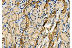 ABIN6266034 and ABIN6277649 at 1/100 staining Rat kidney tissue by IHC-P. (WNK3 Antikörper  (C-Term))