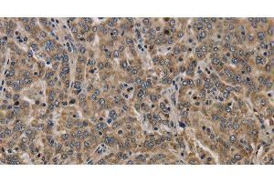 Immunohistochemistry (Paraffin-embedded Sections) (IHC (p)) image for anti-Potassium Large Conductance Calcium-Activated Channel, Subfamily M, beta Member 2 (KCNMB2) antibody (ABIN7243496)
