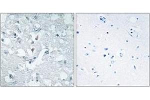 Immunohistochemistry analysis of paraffin-embedded human brain tissue, using GLCTK Antibody.