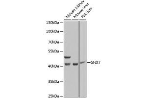 Western blot analysis of extracts of various cell lines, using SNX7 Antibody (ABIN6128732, ABIN6148257, ABIN6148258 and ABIN6223768) at 1:1000 dilution. (Sorting Nexin 7 Antikörper  (AA 85-330))