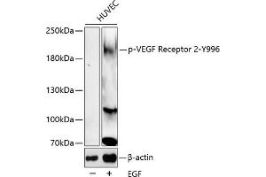Western blot analysis of extracts of HUVEC cell line, using Phospho-VEGF Receptor 2-Y996 antibody (ABIN6135337, ABIN6136290, ABIN6136291 and ABIN6225613). (VEGFR2/CD309 Antikörper  (pTyr996))