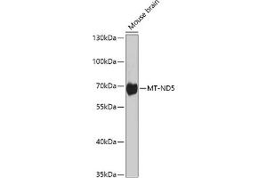 Western blot analysis of extracts of various cell lines, using MT-ND5 antibody (ABIN6135116, ABIN6144435, ABIN6144437 and ABIN6224158) at 1:1000 dilution. (MT-ND5 Antikörper  (AA 500-600))