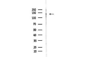 anti-Ubinuclein 1 (UBN1) (Internal Region) antibody