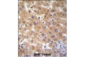 GAGE12B Antibody (N-term) (ABIN655201 and ABIN2844816) immunohistochemistry analysis in formalin fixed and paraffin embedded human liver tissue followed by peroxidase conjugation of the secondary antibody and DAB staining. (G Antigen 12B Antikörper  (N-Term))