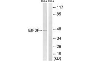Western blot analysis of extracts from HeLa cells, using EIF3F Antibody. (EIF3F Antikörper  (AA 81-130))