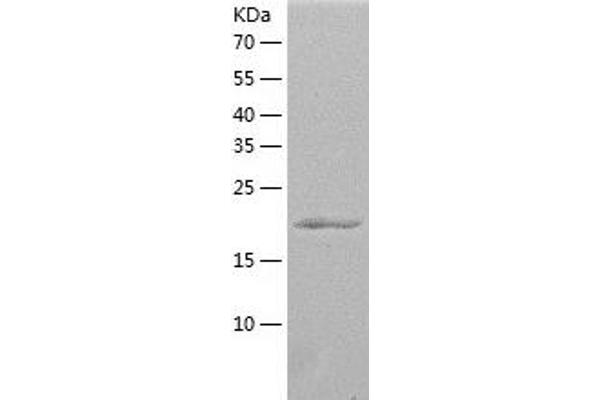 HDGFRP3 Protein (AA 1-203) (His tag)