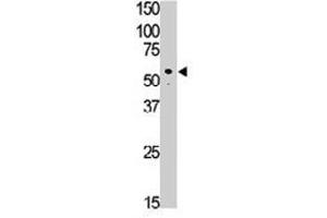 The SIGLEC7 polyclonal antibody  is used in Western blot to detect SIGLEC7 in Jurkat cell lysate. (SIGLEC7 Antikörper  (C-Term))