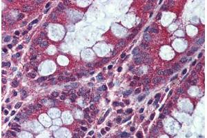Immunohistochemistry (IHC) image for anti-Activin Receptor Type 1C (ACVR1C) (Internal Region) antibody (ABIN1048286)