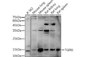 Western blot analysis of extracts of various cell lines, using TGF beta 1 antibody (ABIN6128821, ABIN6149071, ABIN6149073 and ABIN6219327) at 1:1000 dilution. (TGFB1 Antikörper  (AA 30-280))