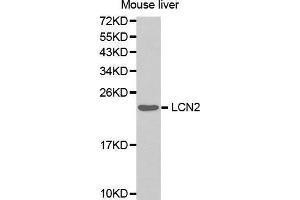 Western Blotting (WB) image for anti-Lipocalin 2 (LCN2) (AA 1-100) antibody (ABIN3017526) (Lipocalin 2 Antikörper  (AA 1-100))