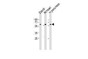 Western blot analysis of lysates from Daudi cell line, human heart and ncreas tissue lysate(from left to right), using CSIN1 Antibody (G23) (ABIN392664 and ABIN2842162). (PACSIN1 Antikörper  (N-Term))