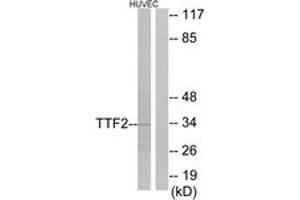 Western Blotting (WB) image for anti-Forkhead Box E1 (Thyroid Transcription Factor 2) (FOXE1) (AA 10-59) antibody (ABIN2889304) (FOXE1 Antikörper  (AA 10-59))