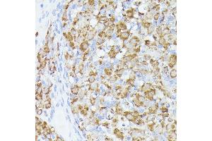 Immunohistochemistry of paraffin-embedded rat ovary using  antibody (ABIN6131166, ABIN6136417, ABIN6136418 and ABIN6223845) at dilution of 1:100 (40x lens). (ACAT2 Antikörper  (AA 1-97))