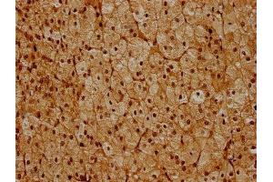 Immunohistochemistry (IHC) image for anti-Proteasome (Prosome, Macropain) 26S Subunit, ATPase, 6 (PSMC6) (AA 1-260), (Regulatory Subunit 10B) antibody (ABIN7142226)