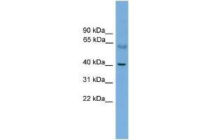 WB Suggested Anti-PRKACA Antibody Titration: 0. (PRKACA Antikörper  (N-Term))