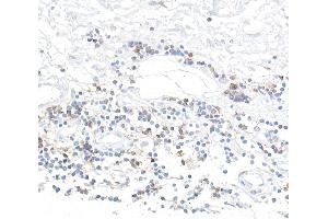 Immunohistochemistry (IHC) image for anti-CD96 (CD96) (AA 29-502) antibody (ABIN7455093) (Rekombinanter CD96 Antikörper  (AA 29-502))