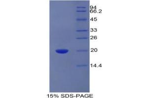 SDS-PAGE analysis of Human PROCR Protein. (PROCR Protein)