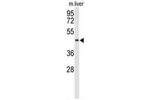 Western blot analysis of CHIA Antibody (N-term) in mouse liver tissue lysates (35µg/lane). (CHIA Antikörper  (N-Term))