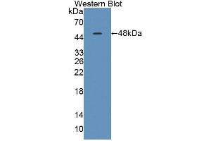 Western blot analysis of the recombinant protein. (TNNC1 Antikörper  (AA 1-161))