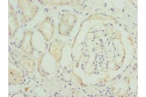 Immunohistochemistry of paraffin-embedded human kidney tissue using ABIN7172352 at dilution of 1:100 (TRAPPC1 Antikörper  (AA 1-260))