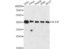Western blot analysis of extracts of various cell lines, using HLA-B antibody (ABIN1873025) at 1:3000 dilution. (HLA-B Antikörper)