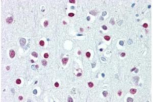 Anti-WHSC1 / NSD2 antibody IHC staining of human brain, cortex.