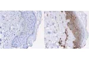 Immunohistochemistry of Rabbit anti-Beta-2-Microglobulin Antibody. (beta-2 Microglobulin Antikörper  (HRP))