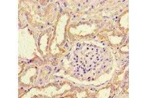 Immunohistochemistry of paraffin-embedded human kidney tissue using ABIN7169234 at dilution of 1:100 (WNK4 Antikörper  (AA 828-1106))