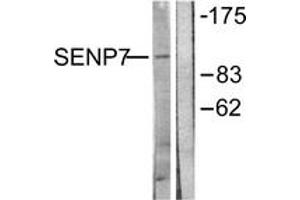 Western blot analysis of extracts from HuvEc cells, using SENP7 Antibody. (SENP7 Antikörper  (AA 991-1040))