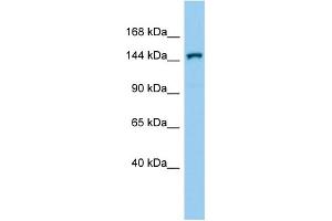 Host:  Rabbit  Target Name:  Corin  Sample Type:  Mouse Testis lysates  Antibody Dilution:  1. (Corin Antikörper  (C-Term))