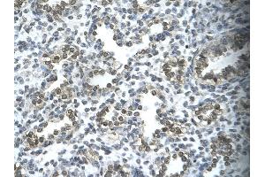Human Lung; . (SUPT5H Antikörper  (C-Term))