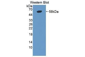 Western blot analysis of the recombinant protein. (TNXB Antikörper  (AA 3835-4088))