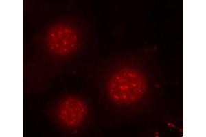 Immunofluorescence (IF) image for anti-Forkhead Box O4 (FOXO4) (pSer197) antibody (ABIN1870198) (FOXO4 Antikörper  (pSer197))