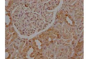 Immunohistochemistry (IHC) image for anti-CD9 (CD9) (AA 112-195) antibody (ABIN7147203)