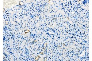 ABIN6260006 and ABIN6279136 at 1/100 staining Rat kidney tissue by IHC-P. (AQP11 Antikörper  (Internal Region))
