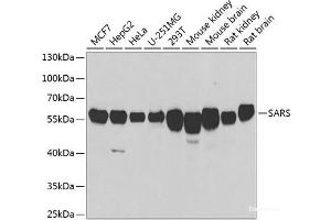 Western blot analysis of extracts of various cell lines using SARS Polyclonal Antibody at dilution of 1:1000. (Seryl-tRNA Synthetase (SARS) Antikörper)