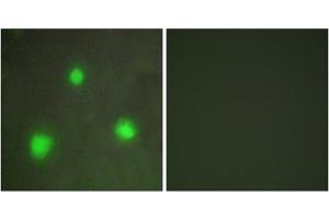 Immunofluorescence analysis of A549 cells, using FOXH1 antibody. (FOXH1 Antikörper  (N-Term))