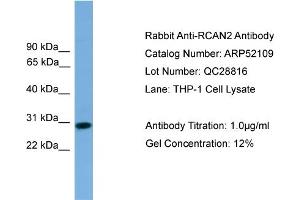 WB Suggested Anti-RCAN2  Antibody Titration: 0. (RCAN2 Antikörper  (Middle Region))