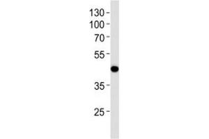 Western blot analysis of lysate from NCI-H292 cell line using AIM2 antibody at 1:1000. (AIM2 Antikörper  (AA 10-40))