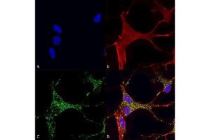 Immunocytochemistry/Immunofluorescence analysis using Mouse Anti-Cav3. (CACNA1G Antikörper  (AA 2052-2172) (Biotin))