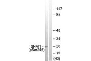 Western blot analysis of extracts from HT29 cells, using SNAI1 (Phospho-Ser246) Antibody. (SNAIL Antikörper  (pSer246))