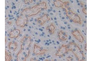 DAB staining on IHC-P; Samples: Rat Kidney Tissue (CD320 Antikörper  (AA 36-256))