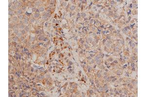 Immunohistochemistry (IHC) image for anti-conserved Helix-Loop-Helix Ubiquitous Kinase (CHUK) (pSer176), (pSer177) antibody (ABIN6256173)